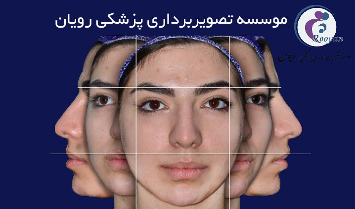 مرکز تخصصی فتوگرافی در کرج
